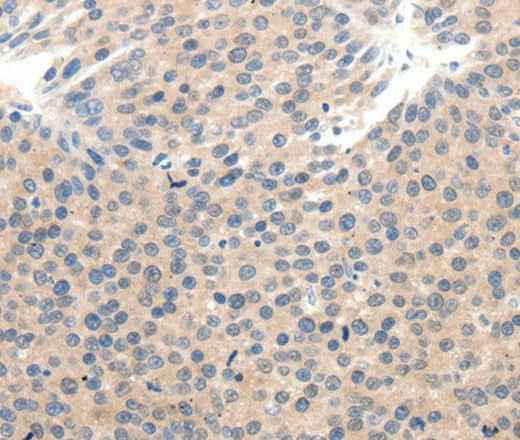 Anti-Human SCN10A Antibody