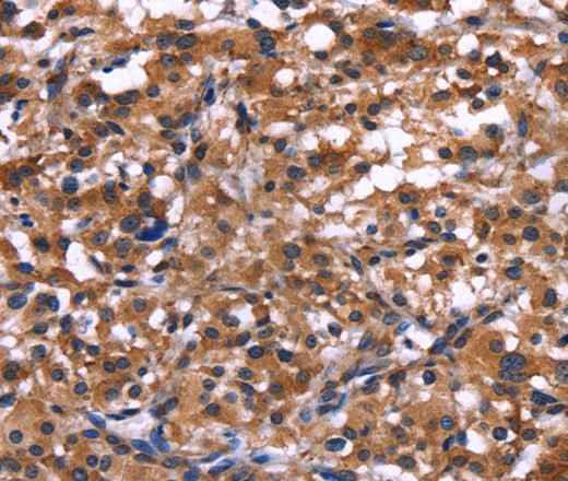 Anti-Human IL1A Antibody