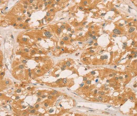 Anti-Human/Rat CPB1 Antibody