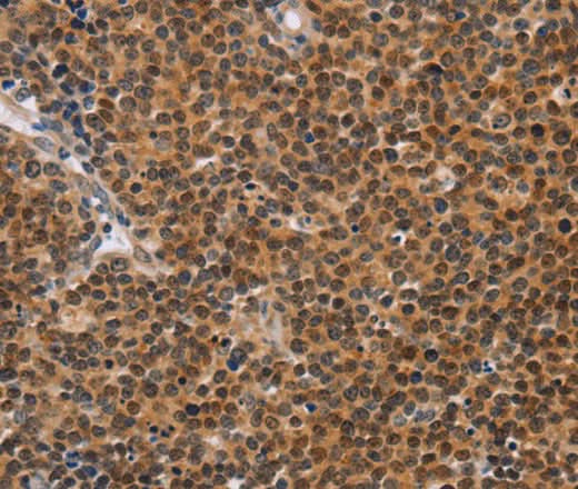 Anti-Human CD36 Antibody - ABMIUM