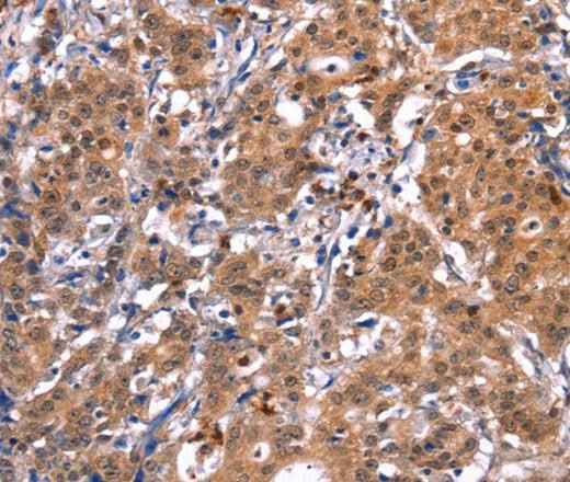 Anti-Human/Mouse/Rat GCG Antibody
