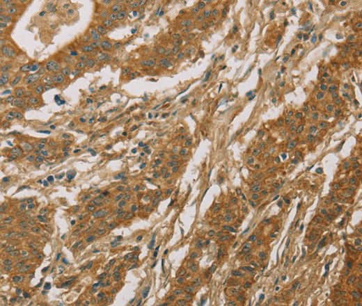 Anti-Human CYP39A1 Antibody - ABMIUM