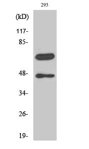 Western Blot analysis of 293 cells with Cleaved-CASP8 (D384) Polyclonal Antibody