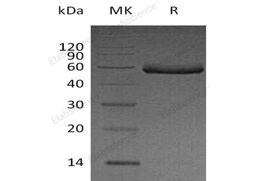 Recombinant Human Fetuin-B/FETUB Protein (His Tag) - ABMIUM