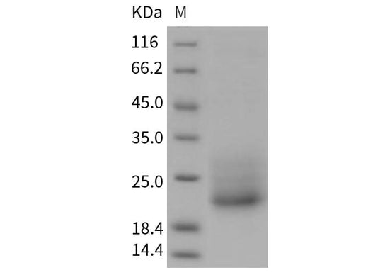 > 94 % as determined by reducing SDS-PAGE.