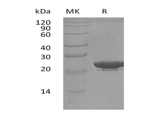 Recombinant Human NGAL/Lipocalin-2 Protein (His Tag, Human Cells) - ABMIUM