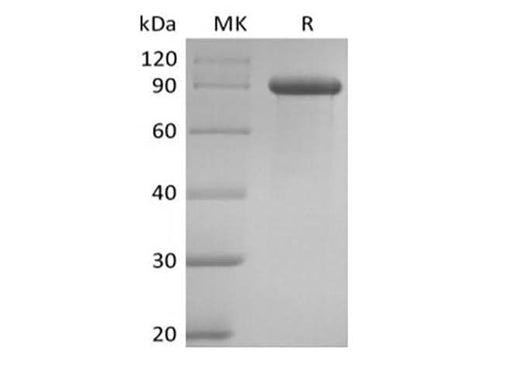 Recombinant Human Delta-like Protein 1/DLL1 (C-Fc) - ABMIUM