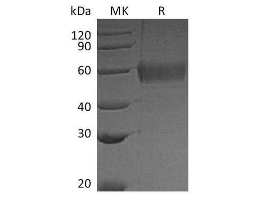 Recombinant Vaccinia virus Soluble Interferon α/β Receptor B18 Protein (His Tag) - ABMIUM
