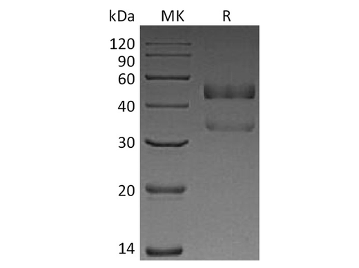 Recombinant Human ANGPTL7 Protein (His Tag) - ABMIUM