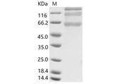 > 75 % as determined by reducing SDS-PAGE.