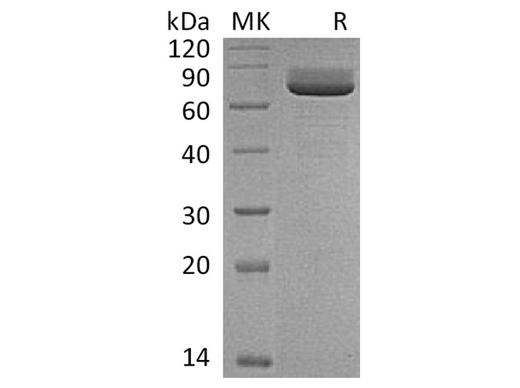 Recombinant Rat CD73/NT5E Protein (His Tag) - ABMIUM