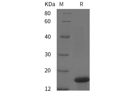 SDS-PAGE analysis of Human IL2/IL-2/Interleukin-2 proteins, 2 μg/lane of Recombinant Human IL2/IL-2/Interleukin-2 proteins was resolved with SDS-PAGE under reducing conditions, showing bands at 17 kDa.