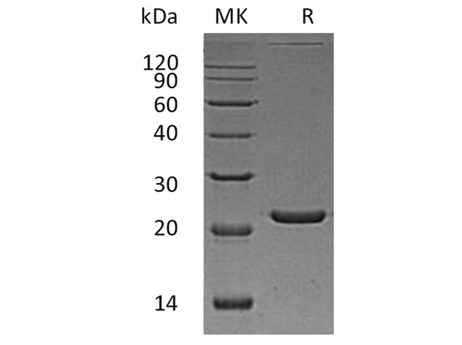 Recombinant Human FTL Protein (His Tag) - ABMIUM
