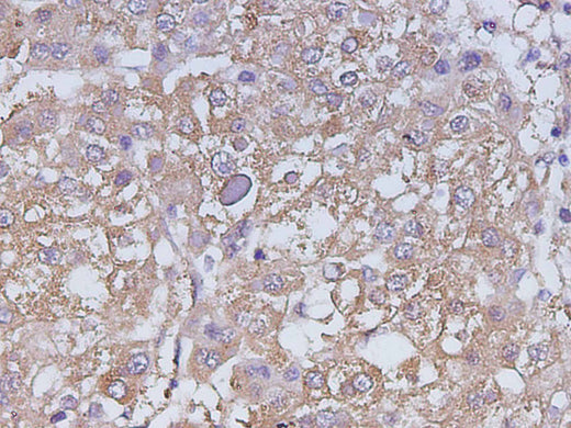 Anti-Human CA199 Antibody - ABMIUM