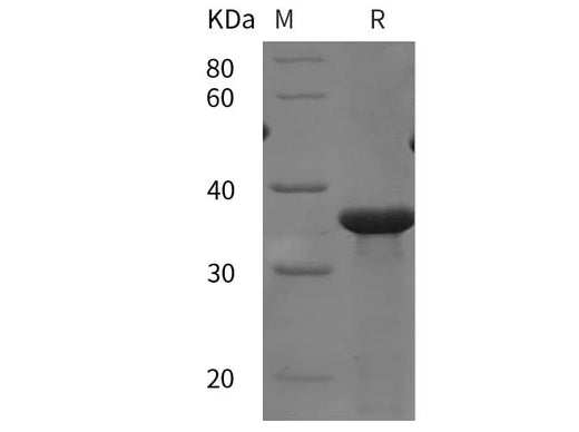 SDS-PAGE analysis of Human TGFBR3/ Betaglycan proteins, 2 μg/lane of Recombinant Human TGFBR3/ Betaglycan proteins was resolved with SDS-PAGE under reducing conditions, showing bands at 35 kDa.