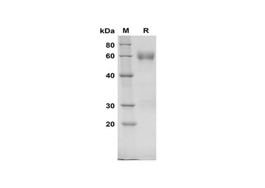 SDS-PAGE analysis of Rat C1Inh proteins, 2 μg/lane of Recombinant Rat C1Inh proteins was resolved with SDS-PAGE under reducing conditions, showing bands at 60 kDa.