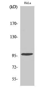 Western Blot analysis of Hela cells using Phospho-CHEK2 (Thr68) Polyclonal Antibody at dilution of 1:500