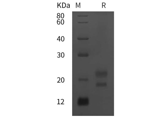 SDS-PAGE analysis of Mouse IL-1ra/IL-1F3 proteins, 2 μg/lane of Recombinant Mouse IL-1ra/IL-1F3 proteins was resolved with SDS-PAGE under reducing conditions, showing bands at 22 kDa.