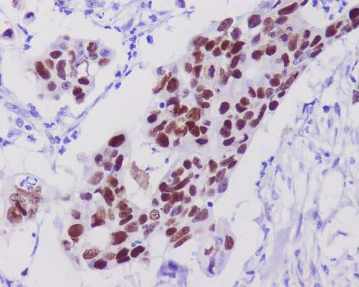 Anti-p53 TP53 Rabbit Monoclonal Antibody Boster Bio