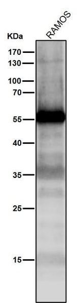 Anti-p53 TP53 Rabbit Monoclonal Antibody Boster Bio