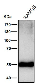 Anti-Mutant p53 Rabbit Monoclonal Antibody Boster Bio