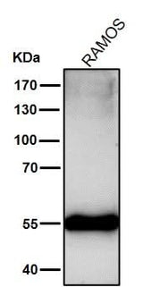 Anti-Mutant p53 Rabbit Monoclonal Antibody Boster Bio