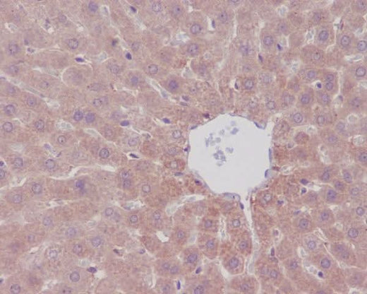 Anti-mTOR/Tor Rabbit Monoclonal Antibody Boster Bio