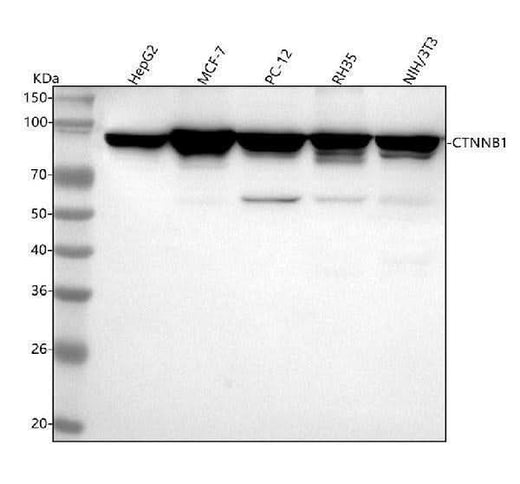 Anti-beta Catenin CTNNB1 Rabbit Monoclonal Antibody Boster Bio