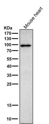 Anti-Phospho-beta Catenin (T41 + S45) Rabbit Monoclonal Antibody Boster Bio