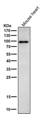 Anti-Phospho-beta Catenin (T41 + S45) Rabbit Monoclonal Antibody Boster Bio