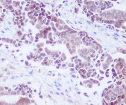 Anti-PTEN Rabbit Monoclonal Antibody Boster Bio