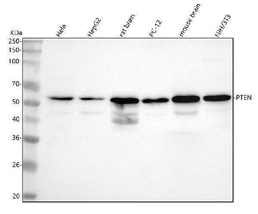 Anti-PTEN Rabbit Monoclonal Antibody Boster Bio