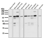 Anti-STAT3 Rabbit Monoclonal Antibody Boster Bio