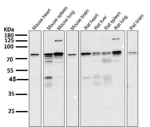 Anti-STAT3 Rabbit Monoclonal Antibody Boster Bio