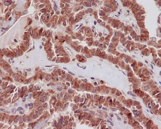 Anti-STAT3 Rabbit Monoclonal Antibody Boster Bio