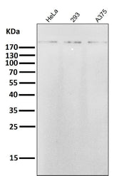 Anti-ErbB2 (HER2) Monoclonal Antibody Boster Bio