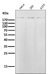 Anti-ErbB2 (HER2) Monoclonal Antibody Boster Bio