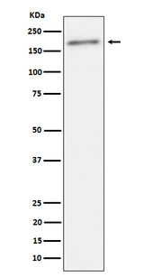 Anti-Phospho-ErbB2(Y1221 + Y1222) Rabbit Monoclonal Antibody Boster Bio
