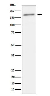 Anti-Phospho-ErbB2(Y1221 + Y1222) Rabbit Monoclonal Antibody Boster Bio