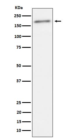 Anti-Phospho-ErbB2(Y1221 + Y1222) Rabbit Monoclonal Antibody Boster Bio