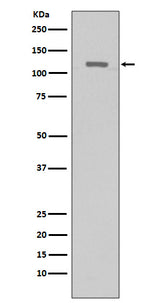 Anti-TERT Rabbit Monoclonal Antibody Boster Bio
