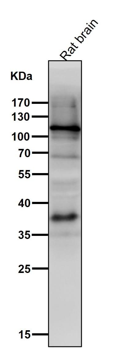 Anti-HIF-1 alpha Rabbit Monoclonal Antibody Boster Bio