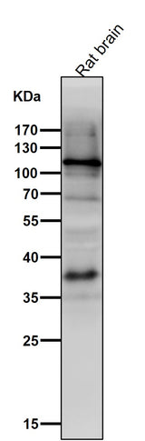 Anti-HIF-1 alpha Rabbit Monoclonal Antibody Boster Bio