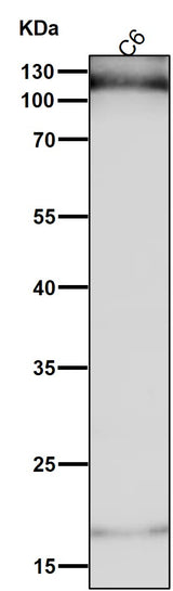 Anti-HIF-1-alpha Rabbit Monoclonal Antibody Boster Bio