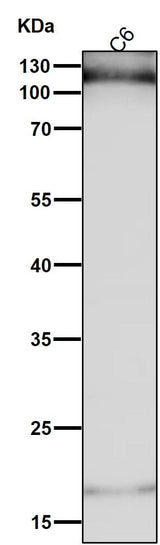 Anti-HIF-1-alpha Rabbit Monoclonal Antibody Boster Bio
