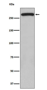 Anti-ATM Monoclonal Antibody Boster Bio
