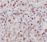 Anti-ATM Monoclonal Antibody Boster Bio