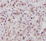 Anti-ATM Monoclonal Antibody Boster Bio