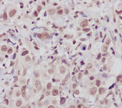 Anti-ATM Monoclonal Antibody Boster Bio