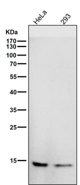 Anti-CDKN2A/p14ARF Rabbit Monoclonal Antibody Boster Bio
